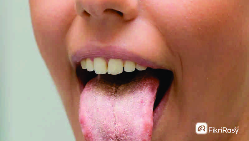 Menghilangkan bau mulut karena mulut kering