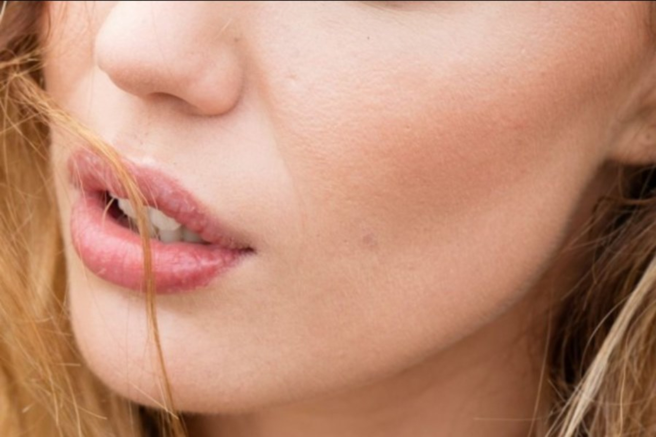 8 Penyebab Bibir Bengkak dari Alergi hingga Kondisi Langka