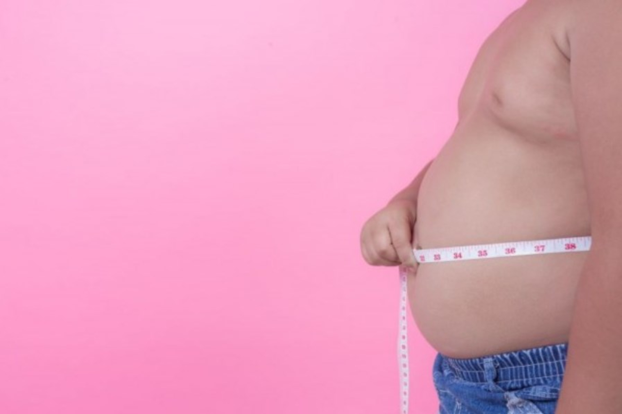 Atasi Obesitas dengan Operasi Bariatrik dan Ini Manfaatnya