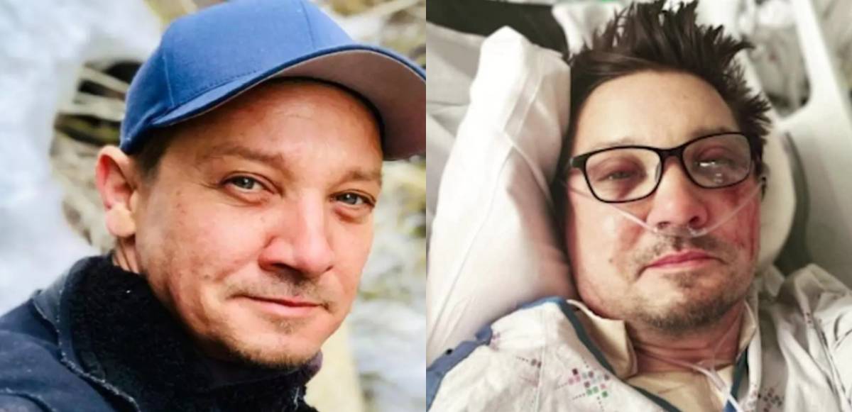 (Latest) Link Video of Snowplow Accident Jeremy Renner